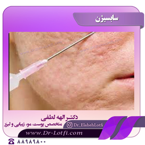 سابسیژن
