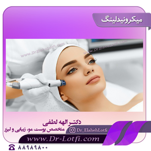 میکرونیدلینگ