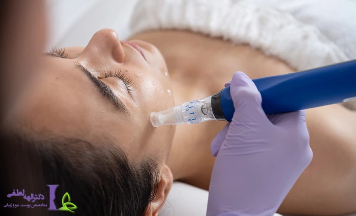 فواید میکرونیدلینگ