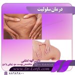 درمان-سلولیت