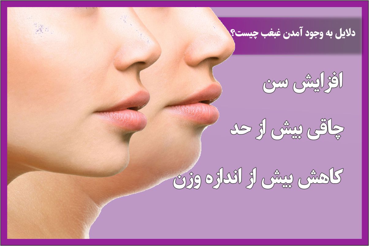 دلایل ایجاد غبغب