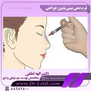 فرم-دهی-بینی-بدون-جراحی