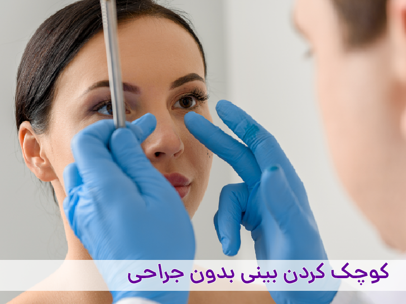 کوچک کردن بینی بدون جراحی