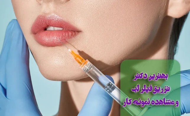 بهترین دکتر تزریق فیلر لب در تهران