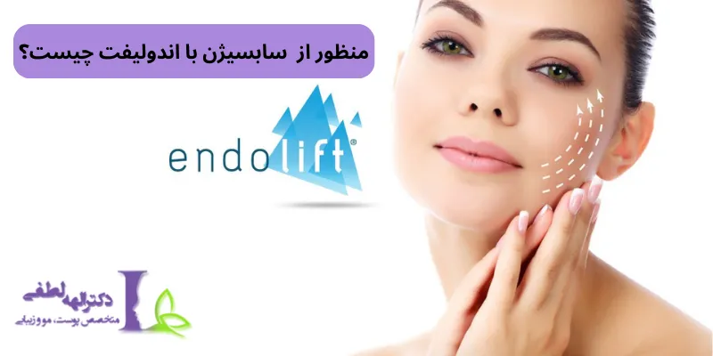 سابسیژن همراه با اندولیفت