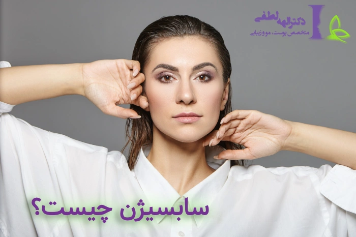 سابسیژن