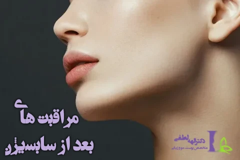مراقبت های بعد از سابسیژن
