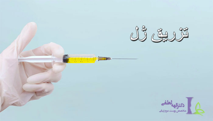 کاربردهای تزریق ژل