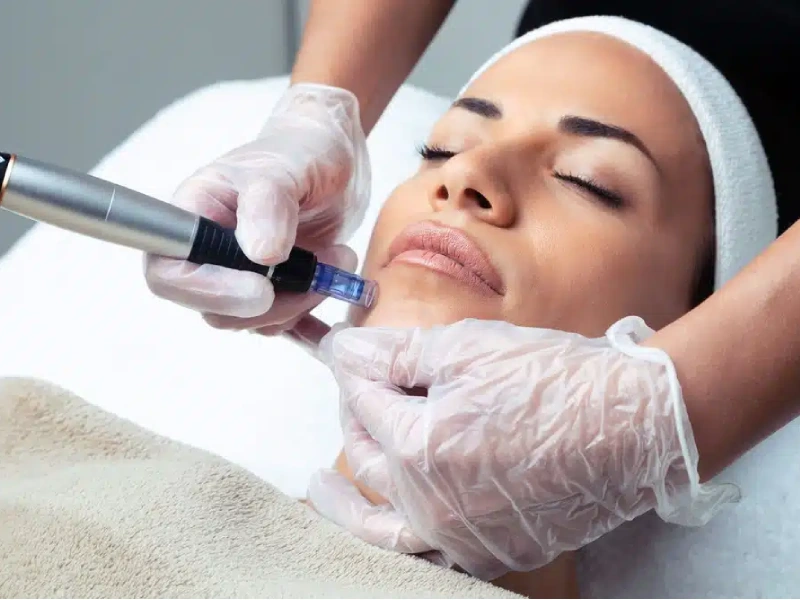 راهنمای کامل مراقبت‌های قبل و بعد از میکرونیدلینگ 