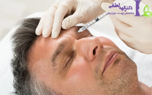 بوتاکس خط اخم و ماندگاری آن