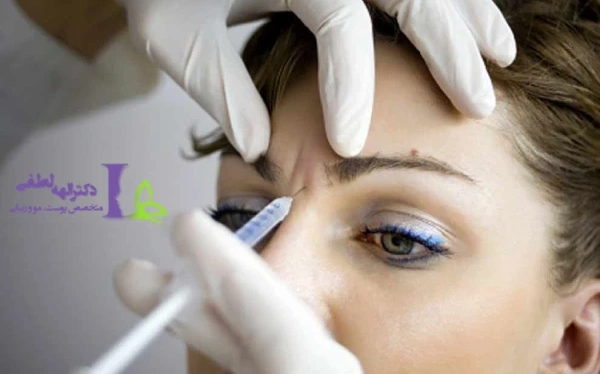 مراحل تزریق بوتاکس