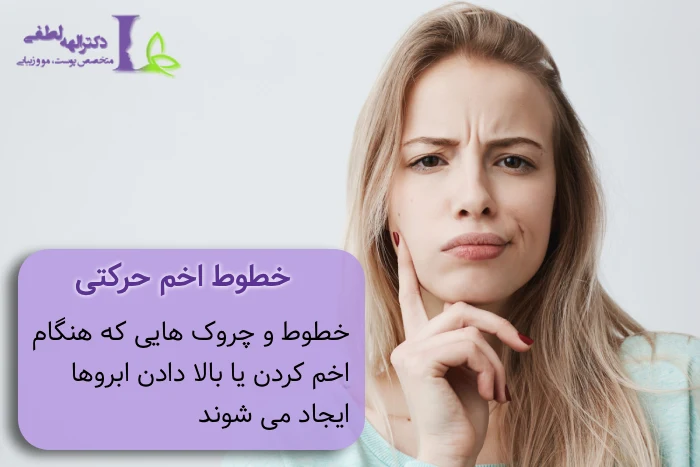 تزریق بوتاکس رفع خط اخم
