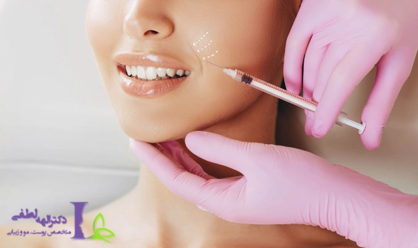 بوتاکس خط خنده چیست؟