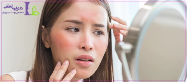 آلرژی و حساسیت به بوتاکس