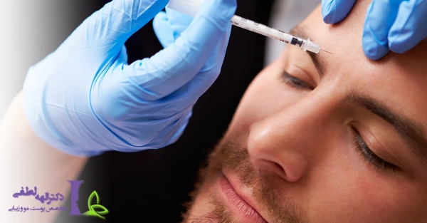 نحوه تزریق بوتاکس در مردان