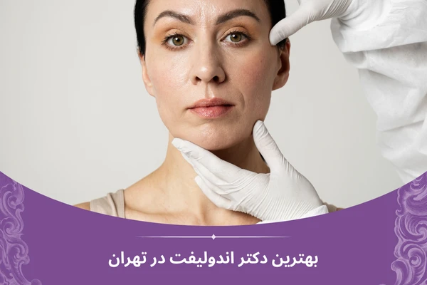 بهترین دکتر اندولیفت در تهران