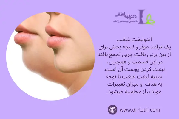 هزینه اندولیفت غبغب