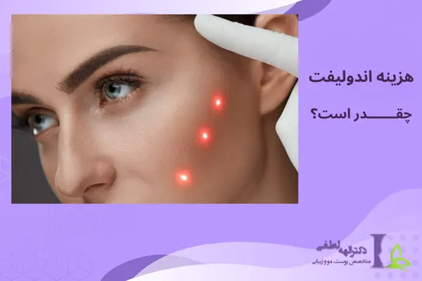 هزینه اندولیفت هزینه اندولیفت