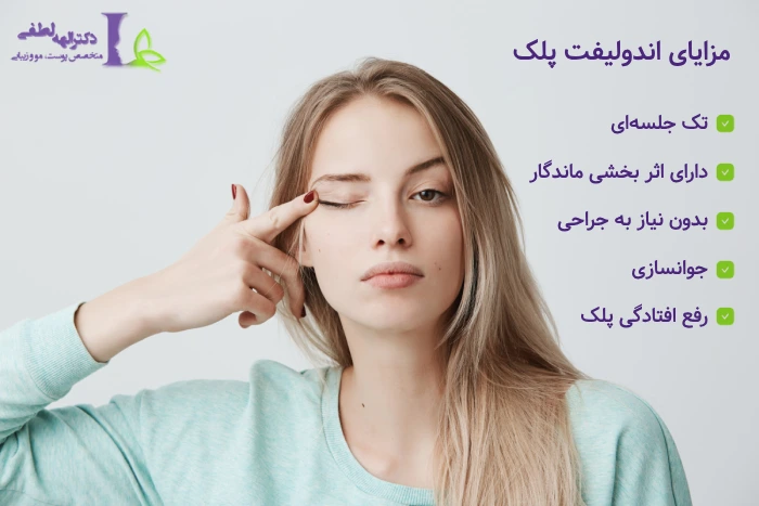 مزایای اندولیفت پلک