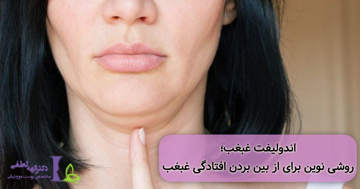 رفع افتادگی غبغب با اندولیفت