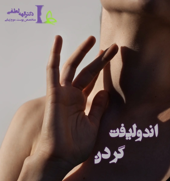 جوانسازی گردن با اندولیفت