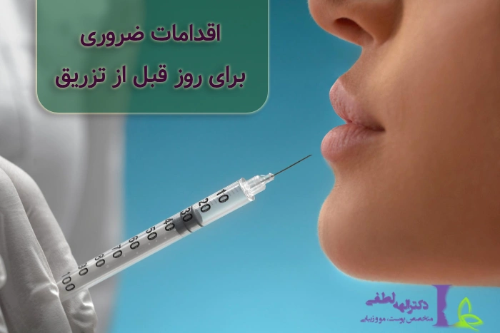اقدامات ضروری قبل از تزریق ژل لب