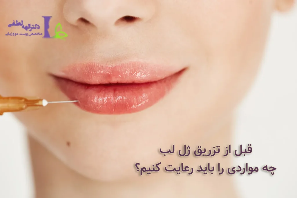 مراقبت های قبل از تزریق ژل لب