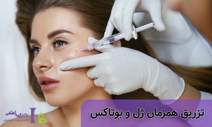 تزریق ژل و بوتاکس