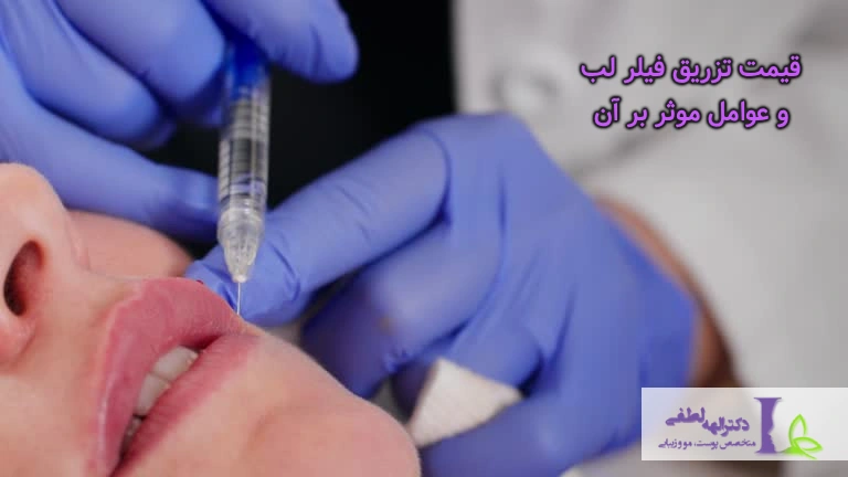 هزینه تزریق ژل لب